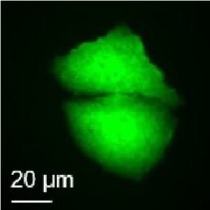 Transfection_GFP_cell_400px